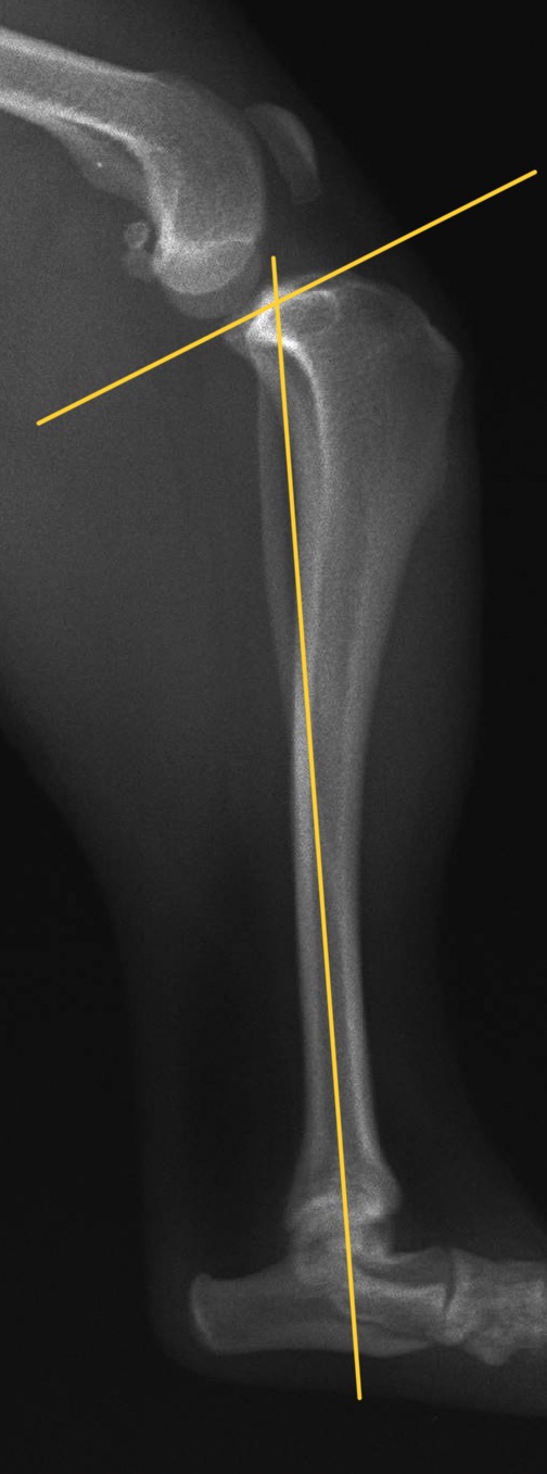 TPLO手術前の犬のすねの骨のレントゲン。黄色の線で、すねの骨の上の面の傾き（TPA）が急なことを示している